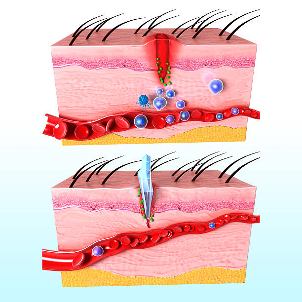 istock immune response of human skin 461866891