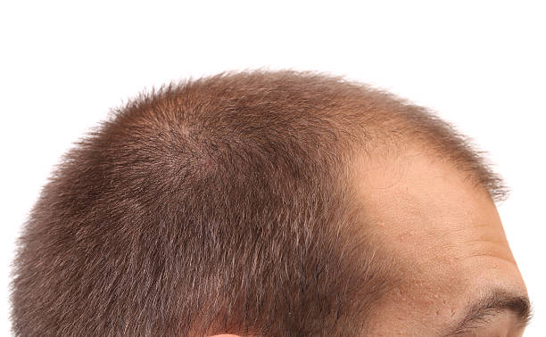 istock Close up of mans head. 461972177
