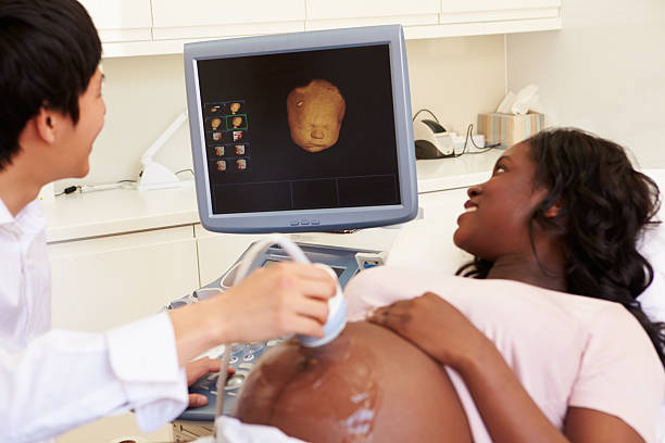 mujer embarazada teniendo 4d ecografía - ultrasound human pregnancy ultrasound machine doctor fotografías e imágenes de stock