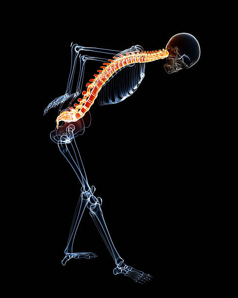 istock skeleton back pain anatomy in black 462162619