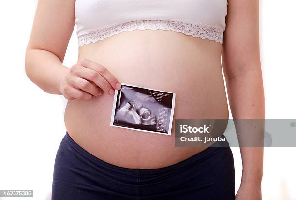 Schwangere Frau Mit Ultraschallfotografie Stockfoto und mehr Bilder von Arzt - Arzt, Baby, Bauch