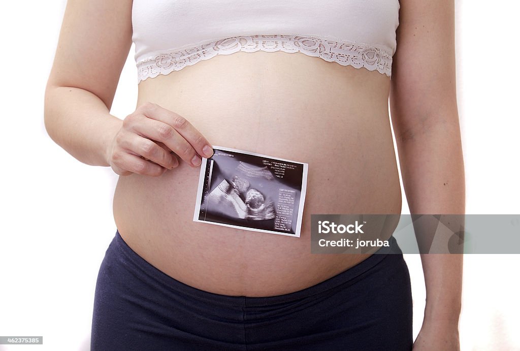 Беременная женщина с УЗИ фотография - Стоковые фото Беременная роялти-фри