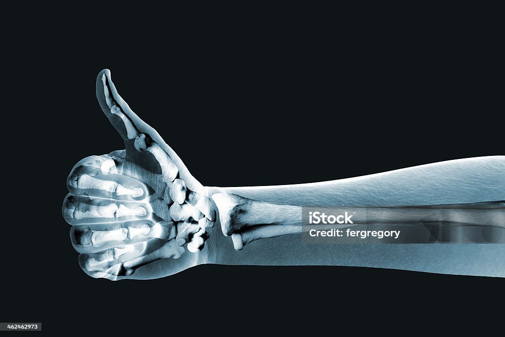 dramatized x ray of a hand thumbs up x-ray hand on black background X-ray Image Stock Photo