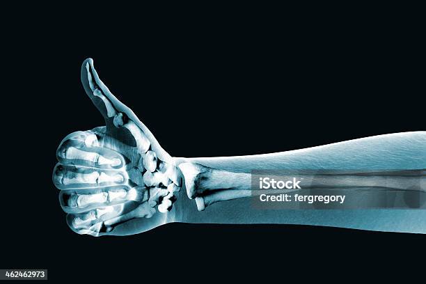 Dramatized X Ray Of A Hand Thumbs Up Stock Photo - Download Image Now - X-ray Image, Orthopedics, Medical X-ray
