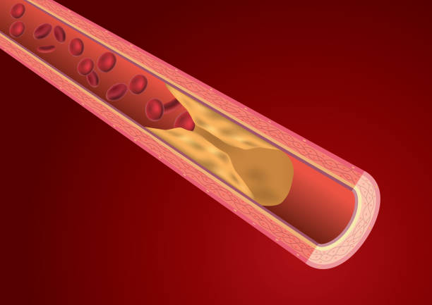 차단기록 혈관 - antithrombin stock illustrations