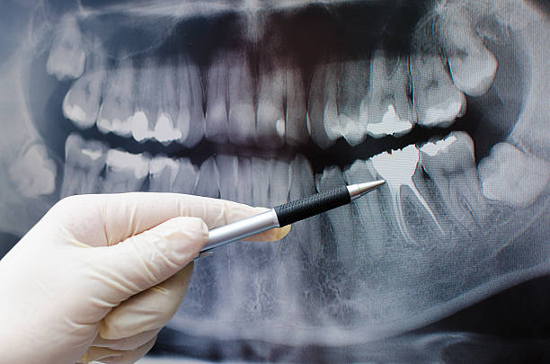 dentista mostrando o raio-x do dentista imagem - x ray image radiologist examining using voice imagens e fotografias de stock