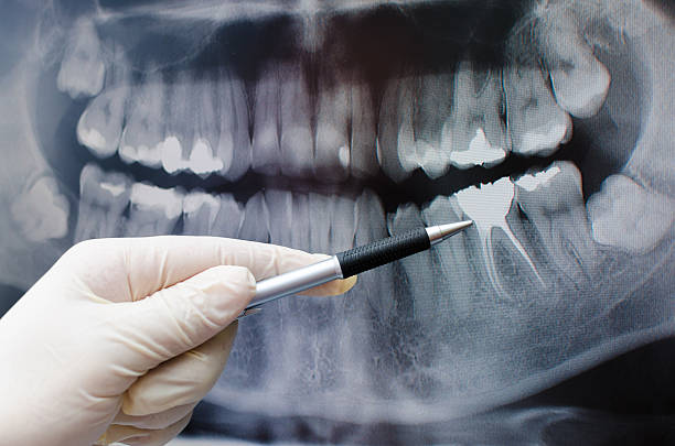 стоматолог, показывая что-то на зубов изображение - x ray image radiologist examining using voice стоковые фото и изображения