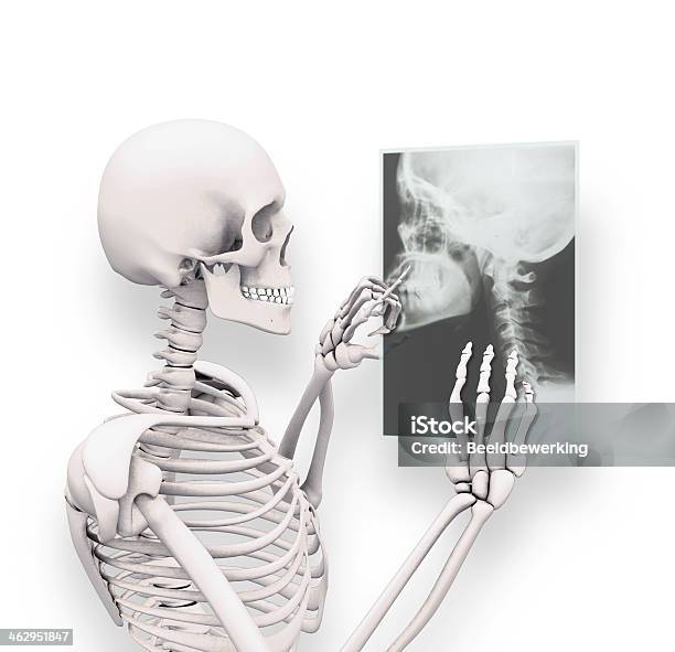 Foto de Xray Cabeça e mais fotos de stock de Esqueleto Humano - Esqueleto Humano, Humor, Adulto