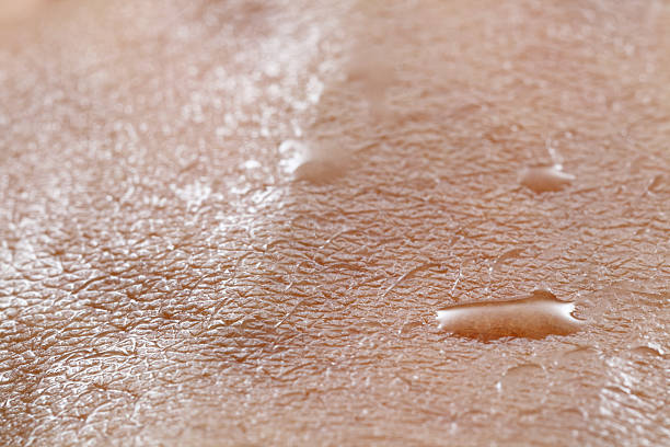 istock Skin sweated close up 463185209