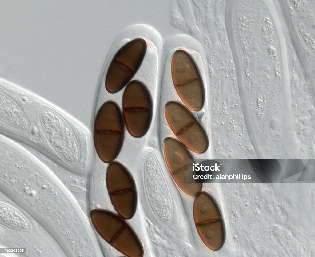Asci 및 ascospores 의 자낭균 균류 Dothiorella sarment - 로열티 프리 0명 스톡 사진
