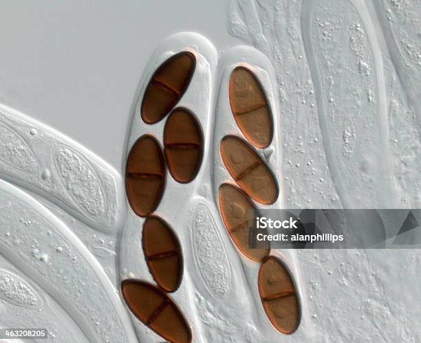 Asci 및 Ascospores 의 자낭균 균류 Dothiorella Sarment 0명에 대한 스톡 사진 및 기타 이미지 - 0명, 과학, 과학 현미경 사진
