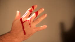 Blood Hand Accident Stock Video - Download Video Clip Now - 2015, Adult,  Art - iStock