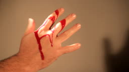 Blood Hand Accident Stock Video - Download Video Clip Now - 2015, Adult, Art - iStock Blood Hand Accident Stock Video - Download Video Clip Now - 2015, Adult, Art - iStock