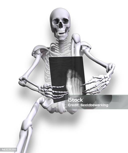 Xray Cuadrados Foto de stock y más banco de imágenes de Esqueleto humano - Esqueleto humano, Humor, Adulto