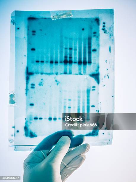 Adn De Los Resultados De Análisis Genéticos Foto de stock y más banco de imágenes de Gel de secuenciación - Gel de secuenciación , ADN, Electroforesis