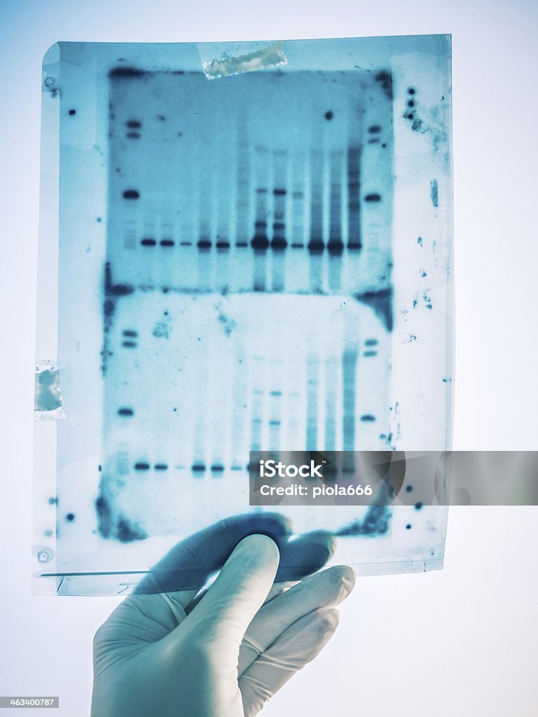 DNA 유전자 분석 결과 - 로열티 프리 DNA 염기서열 젤 스톡 사진