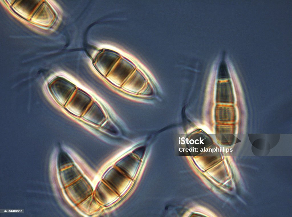Гриб spores фазы контрастной - Стоковые фото Conidiophore роялти-фри
