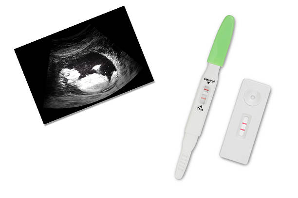 istock ultrasound film with pregnancy test on white background 463452909