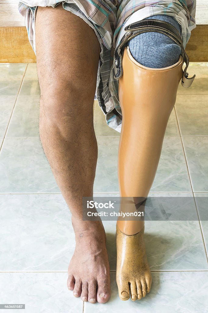 Pierna ortopédica - Foto de stock de Adulto libre de derechos