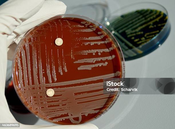 Batteri - Fotografie stock e altre immagini di Klebsiella pneumoniae - Klebsiella pneumoniae, Agar, Analizzare