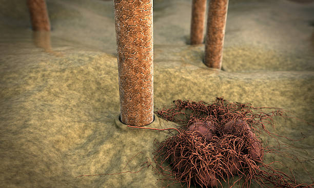 istock hair, fungus 463756169