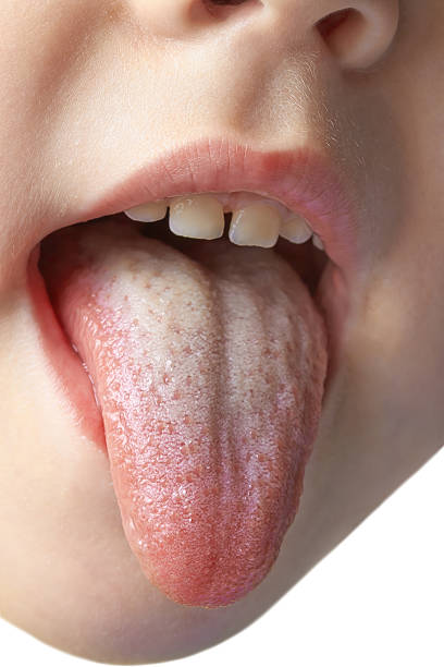 istock tongue kids 464225741