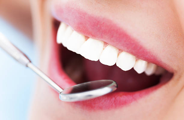 istock Woman teeth and a dentist mouth mirror 464281615