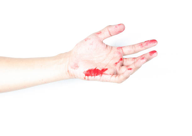istock Hand in blood on a white background 464427591