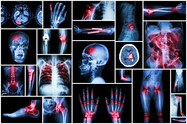 x 線複数の疾患 - cat scan pelvis hip human spine ストックフォトと画像