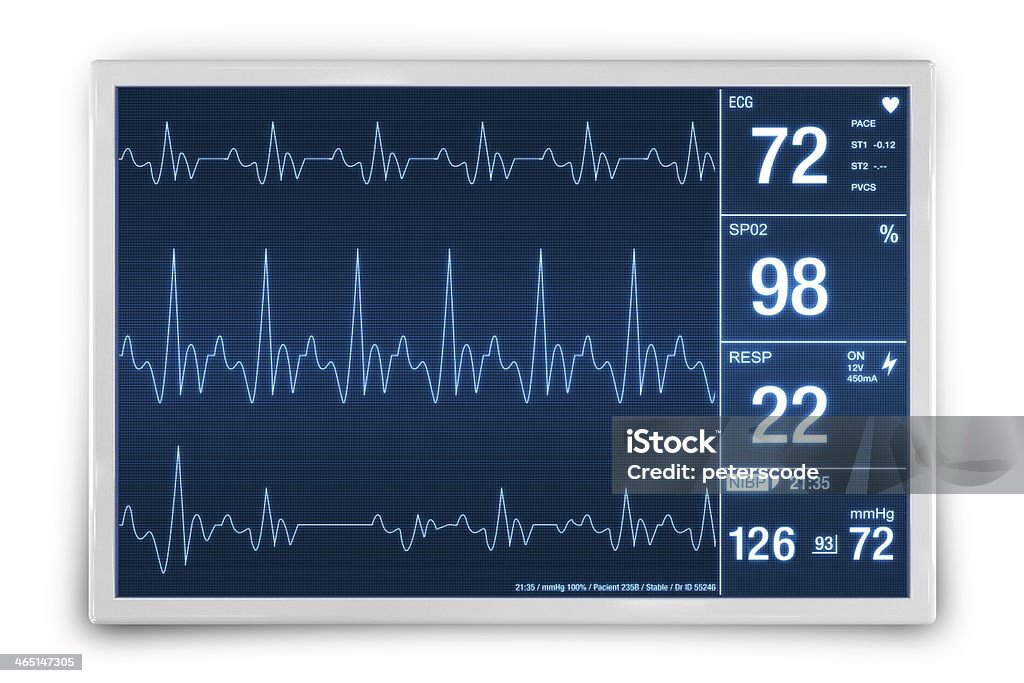 Heart Rate Monitoring Device Heart Rate Monitoring Device 3D Render Illustration. Healthcare Technology. Alertness Stock Photo