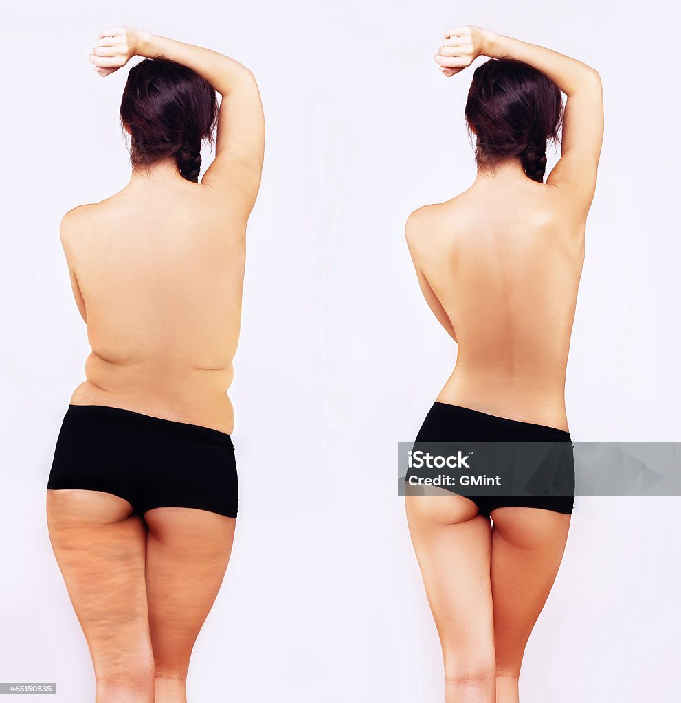 Fat fille debout à côté d'un skinny une - Photo de Liposuccion libre de droits