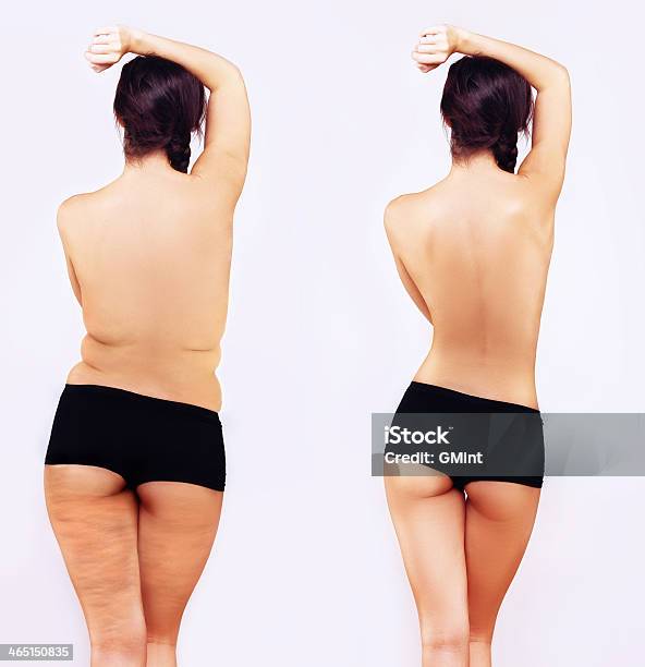 Fat Girl Standing Next To A Skinny One Stock Photo - Download Image Now - Liposuction, Overweight, Defeat