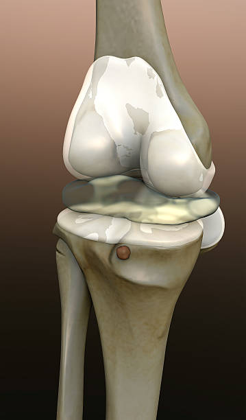 osso, ginocchio umano - human bone forensic science medical scan morphology foto e immagini stock