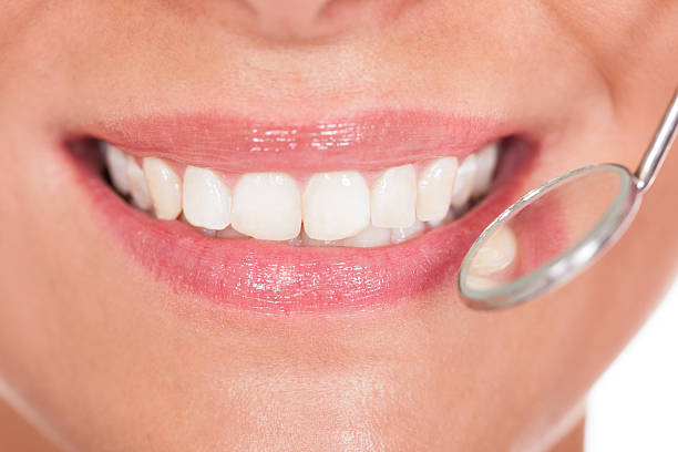 istock Smiling woman with perfect white teeth 465466731