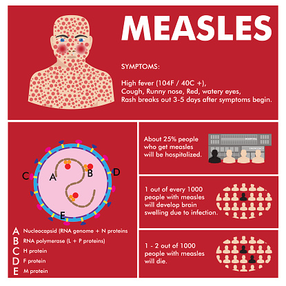 Measles Introduction Vector Measles Infographic Stock Illustration - Download Image Now ...