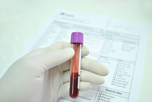 sanguin tube dans la main de scientifique - blood blood donation healthcare and medicine giving photos et images de collection
