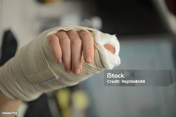 A Hand With A Bandage On It And Thumb In Splint Stock Photo - Download Image Now - 2015, Adult, Bandage