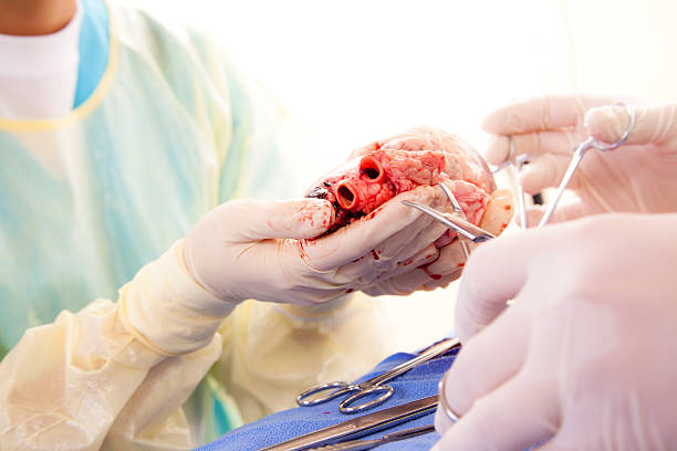 Healthcare: Medical students learn heart surgery procedure. Cardiac surgeon or interns holding heart during open heart surgery.  Heart transplant or artificial heart transplant operation. Surgical tools, gloves. heart surgery photos stock pictures, royalty-free photos & images