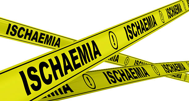 istock Ischaemia. Yellow warning tapes 465978412