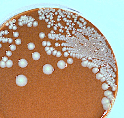 White shiny bacterial colonies of different sizes grown on brown nutrient agar.