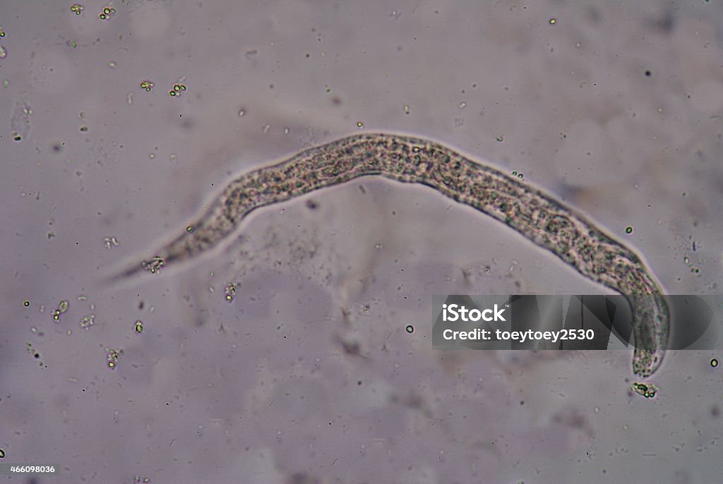 Strongyloides stercoralis Strongyloides stercoralis is a human parasitic roundworm causing the disease strongyloidiasis 2015 Stock Photo