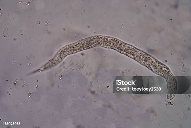 Strongyloides Stercoralis Stock Photo - Download Image Now - 2015, Animal, Annelid