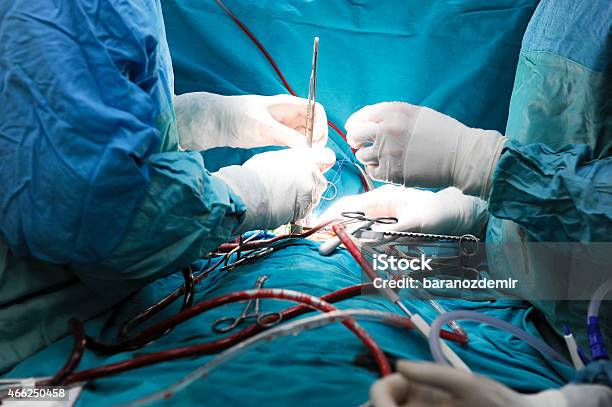 Pediatric Heart Surgery Stock Photo - Download Image Now - Heart Surgery, Child, Surgery