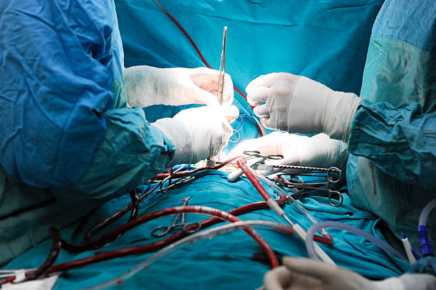 pediatryczny chirurgia serca - surgeon human hand surgery anesthetic zdjęcia i obrazy z banku zdjęć
