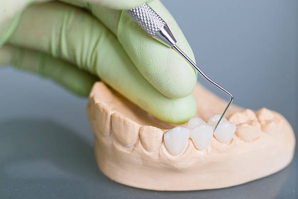dental - dental hygiene prosthetic equipment dentist office dental equipment fotografías e imágenes de stock