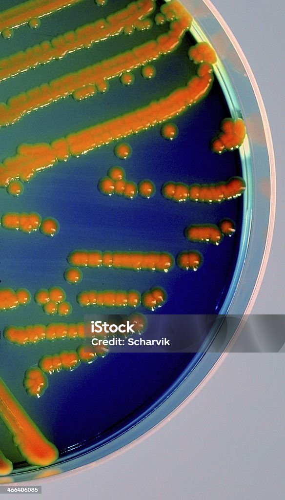 Escherichia coli - Foto de stock de Cistitis libre de derechos