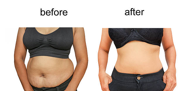 after a diet Woman's body before and after a diet before and after weight loss stock pictures, royalty-free photos & images