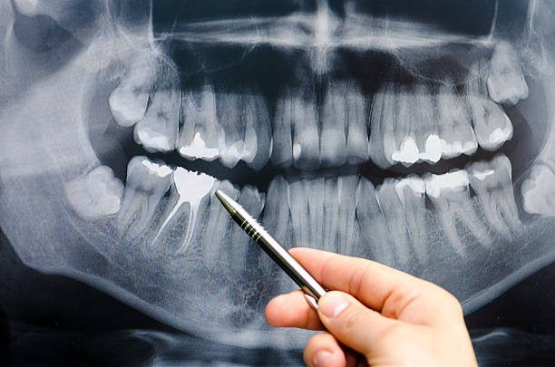 歯科歯を示すものに x 線画像 - radiologist cat scan x ray cat scan machine ストックフォトと画像