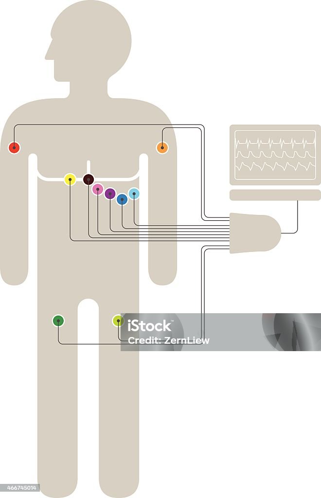 ECG / EKG Wiring Diagram ECG wiring diagram showing 6+2+2 colour-coded sensors connected to a trunk / break-out box and a laptop computer. Electrocardiography stock vector
