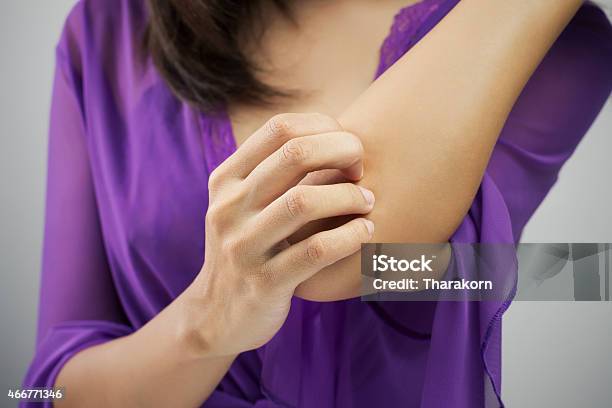 Itching Stock Photo - Download Image Now - Scratching, Women, Dermatitis